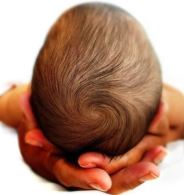 mother babies Baby Plagiocephaly Flat Head North East England Newcastle Catherine Williams