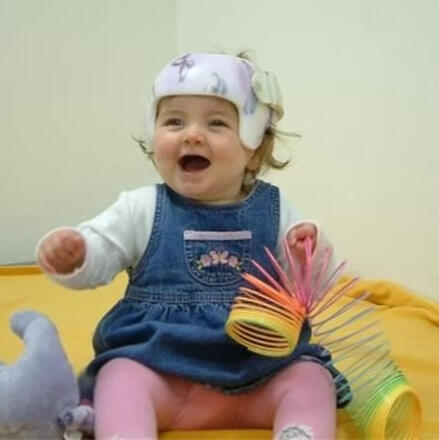 Child Flat Head Newcastle Catherine Williams Locband Baby Plagiocephaly Flat Head North East England Newcastle