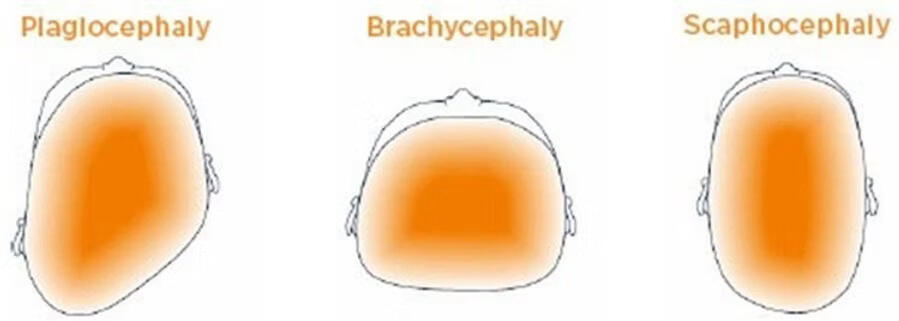 Family Wellbeing Catherine Williams Ahead for Health Baby Cranio Sacral Therapy Newcastle North East England